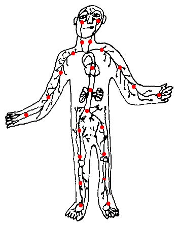 artery1.gif (12958 bytes)