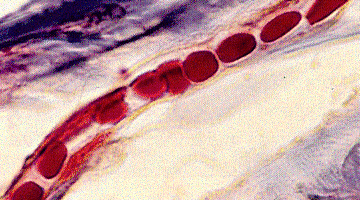 blood1.gif (82664 bytes)