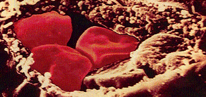 blood2.gif (98615 bytes)