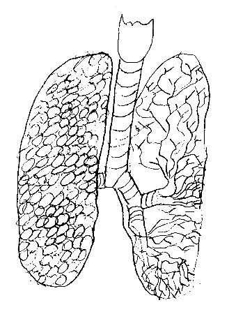 lungs.gif (19327 bytes)